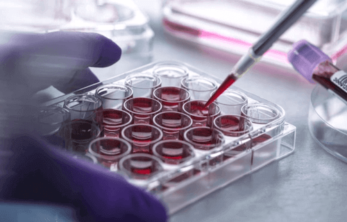 L'action AB Science bondit de 4,15 % à mi-journée et retrouve un plus haut de 3 mois